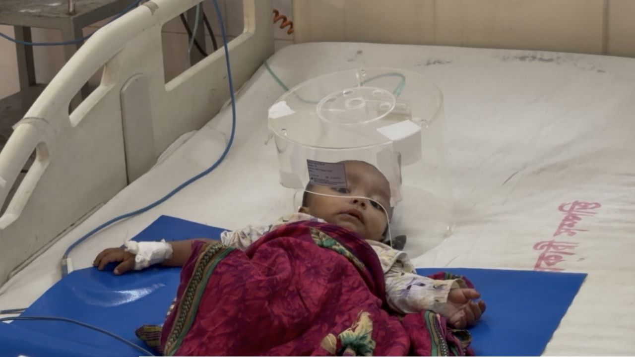 হাম উপসর্গ: সিলেটে মৃত্যু বেড়ে ৩৭, কমেছে আক্রান্ত