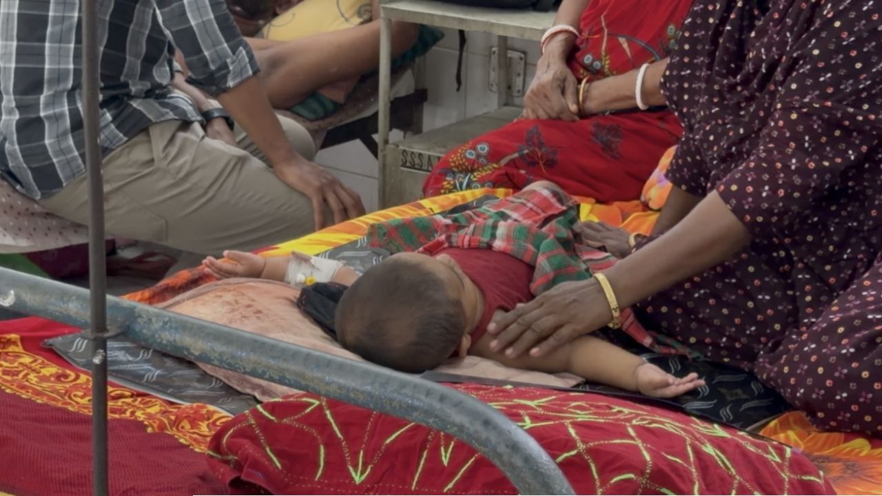 সিলেটে হাম উপসর্গে আরও ৩ শিশুর মৃত্যু