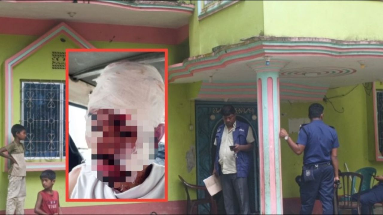 মাতামুহুরীর রামপুরে দুর্ধর্ষ ডাকাতি, ডাকাত ধরতে গিয়ে যুবক গুরুতর আহত